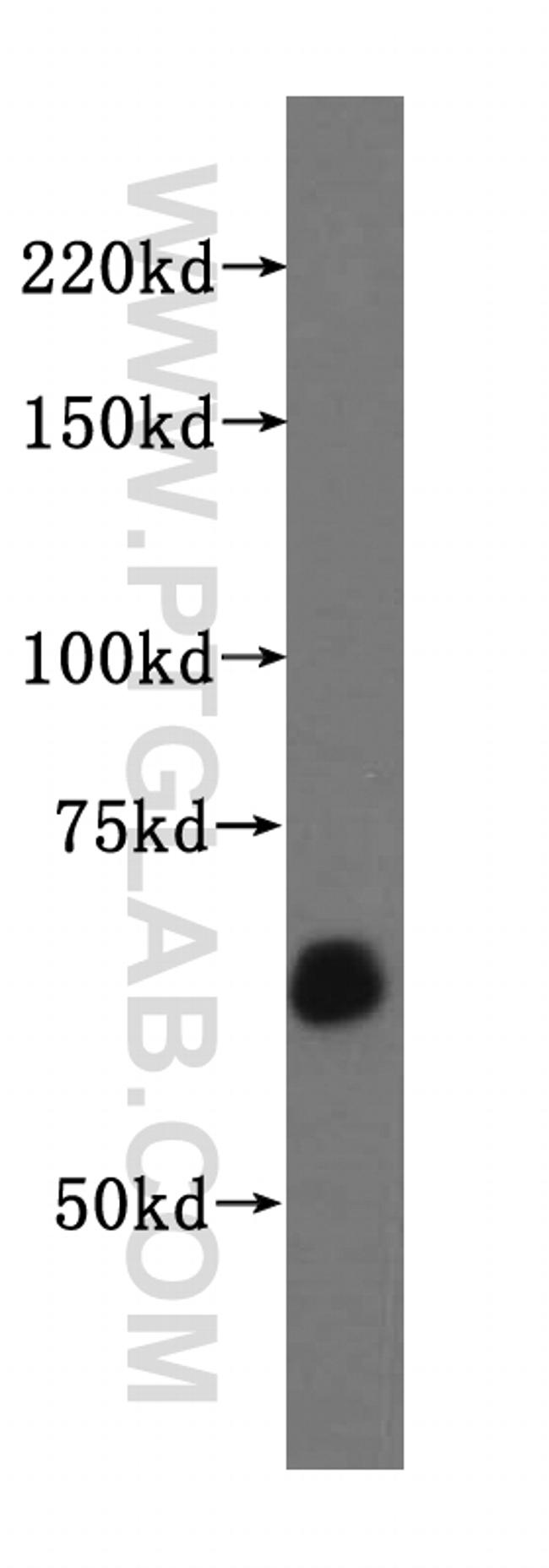 TAF6L Antibody in Western Blot (WB)