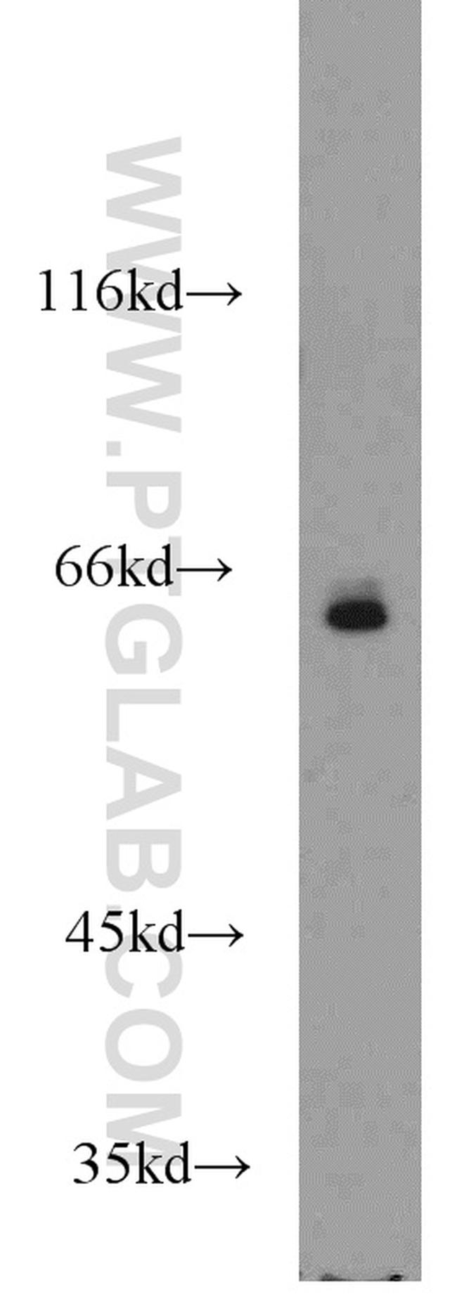 TAF6L Antibody in Western Blot (WB)