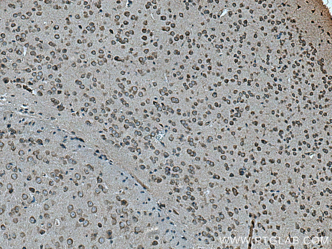 SLC7A4 Antibody in Immunohistochemistry (Paraffin) (IHC (P))