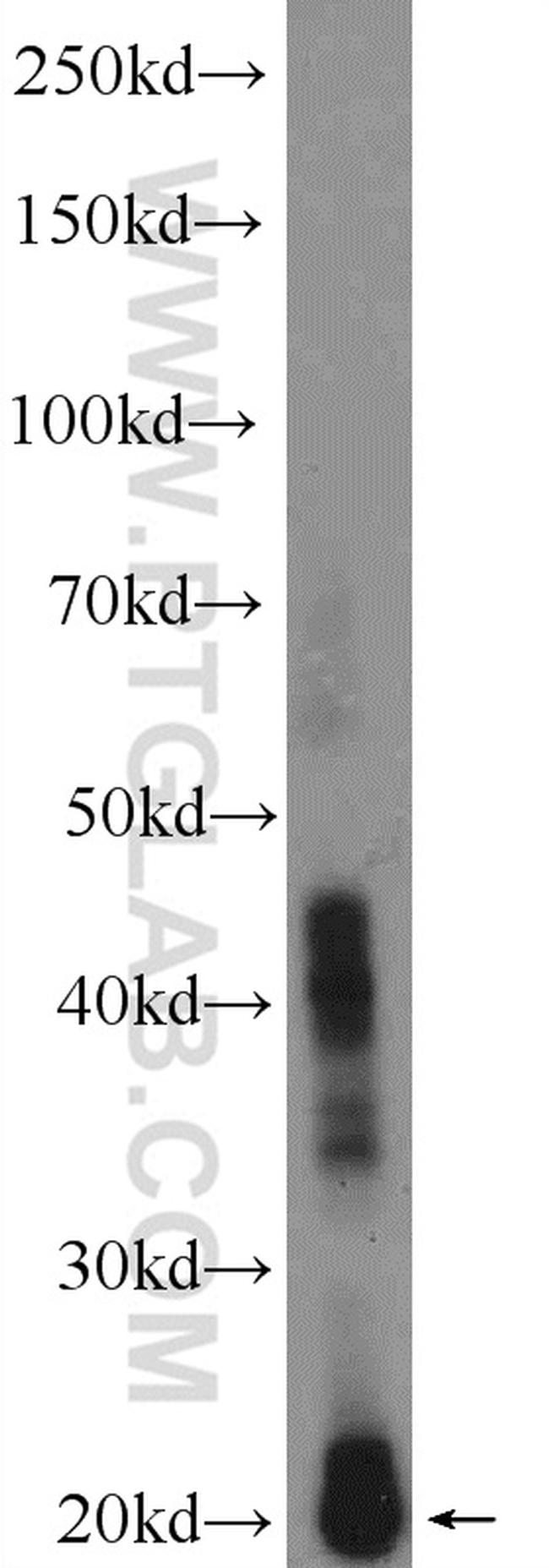 CRYBA2 Antibody in Western Blot (WB)