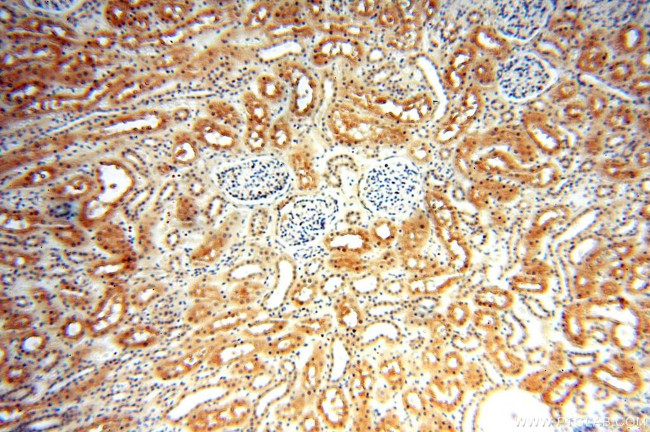 TRBP Antibody in Immunohistochemistry (Paraffin) (IHC (P))