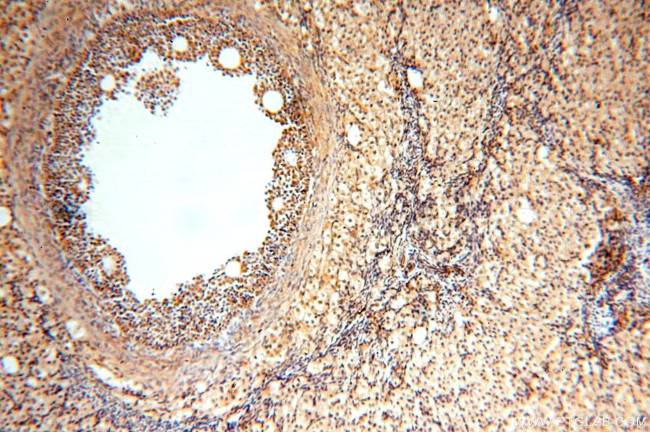 TRBP Antibody in Immunohistochemistry (Paraffin) (IHC (P))