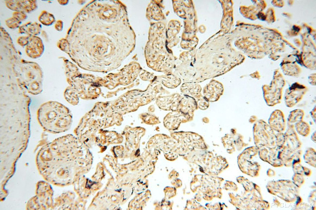 TRBP Antibody in Immunohistochemistry (Paraffin) (IHC (P))