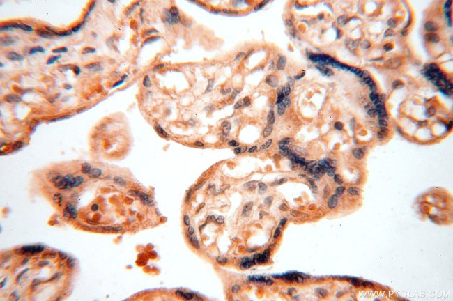 TRBP Antibody in Immunohistochemistry (Paraffin) (IHC (P))