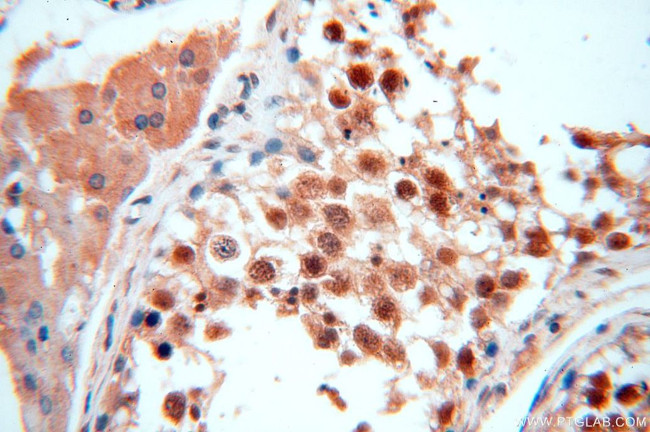 TRBP Antibody in Immunohistochemistry (Paraffin) (IHC (P))