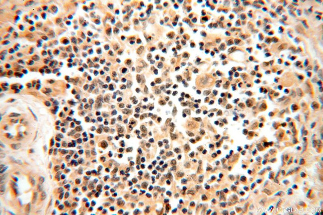 TRBP Antibody in Immunohistochemistry (Paraffin) (IHC (P))