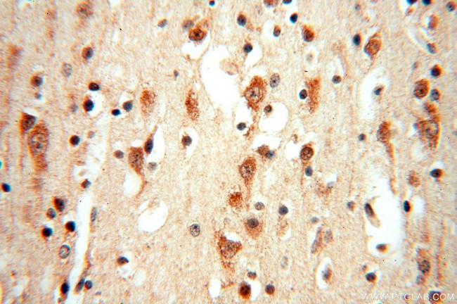 TRBP Antibody in Immunohistochemistry (Paraffin) (IHC (P))