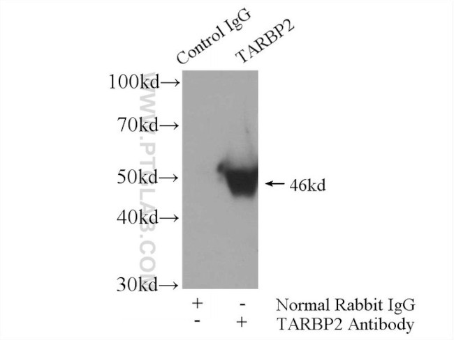 TRBP Antibody in Immunoprecipitation (IP)