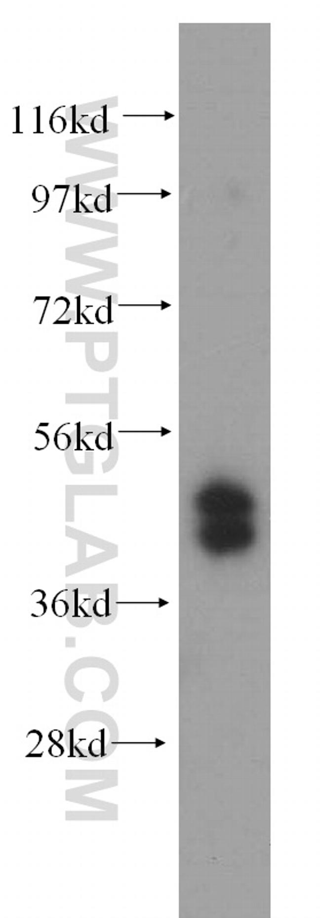 TRBP Antibody in Western Blot (WB)