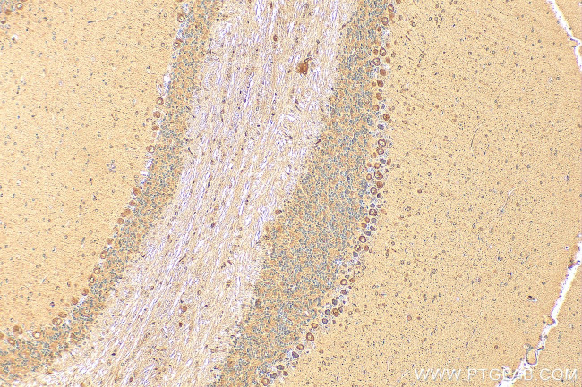 C1QL1 Antibody in Immunohistochemistry (Paraffin) (IHC (P))