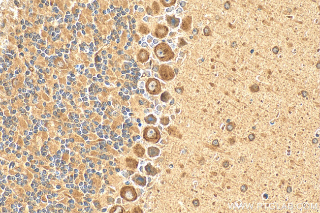 C1QL1 Antibody in Immunohistochemistry (Paraffin) (IHC (P))