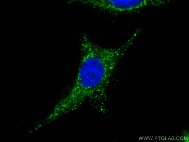 MEK5 Antibody in Immunocytochemistry (ICC/IF)