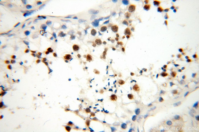 MEK5 Antibody in Immunohistochemistry (Paraffin) (IHC (P))