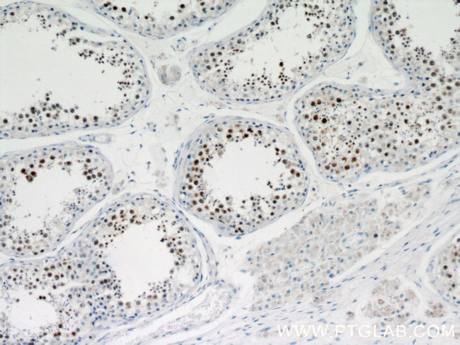 MEK5 Antibody in Immunohistochemistry (Paraffin) (IHC (P))