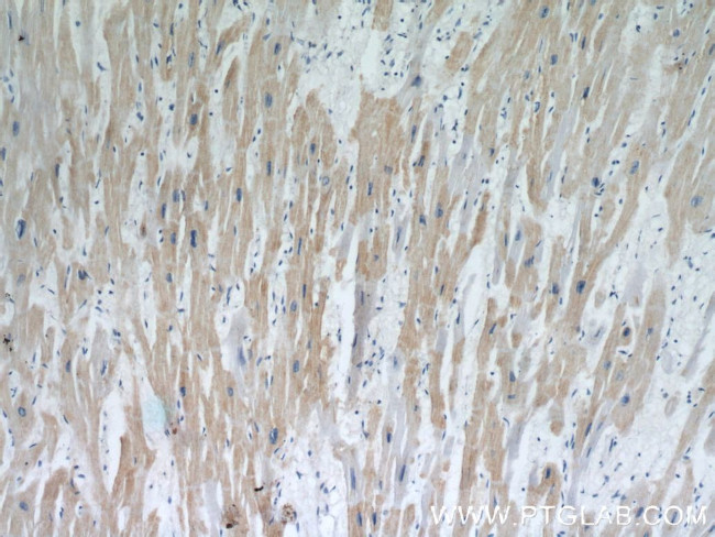 MEK5 Antibody in Immunohistochemistry (Paraffin) (IHC (P))