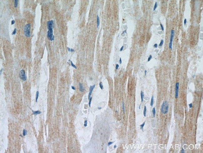 MEK5 Antibody in Immunohistochemistry (Paraffin) (IHC (P))