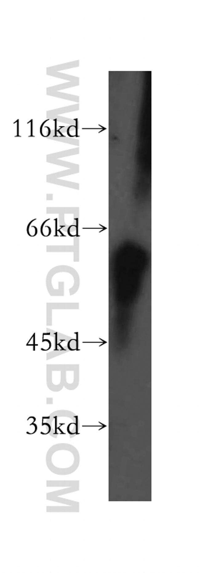 MEK5 Antibody in Western Blot (WB)