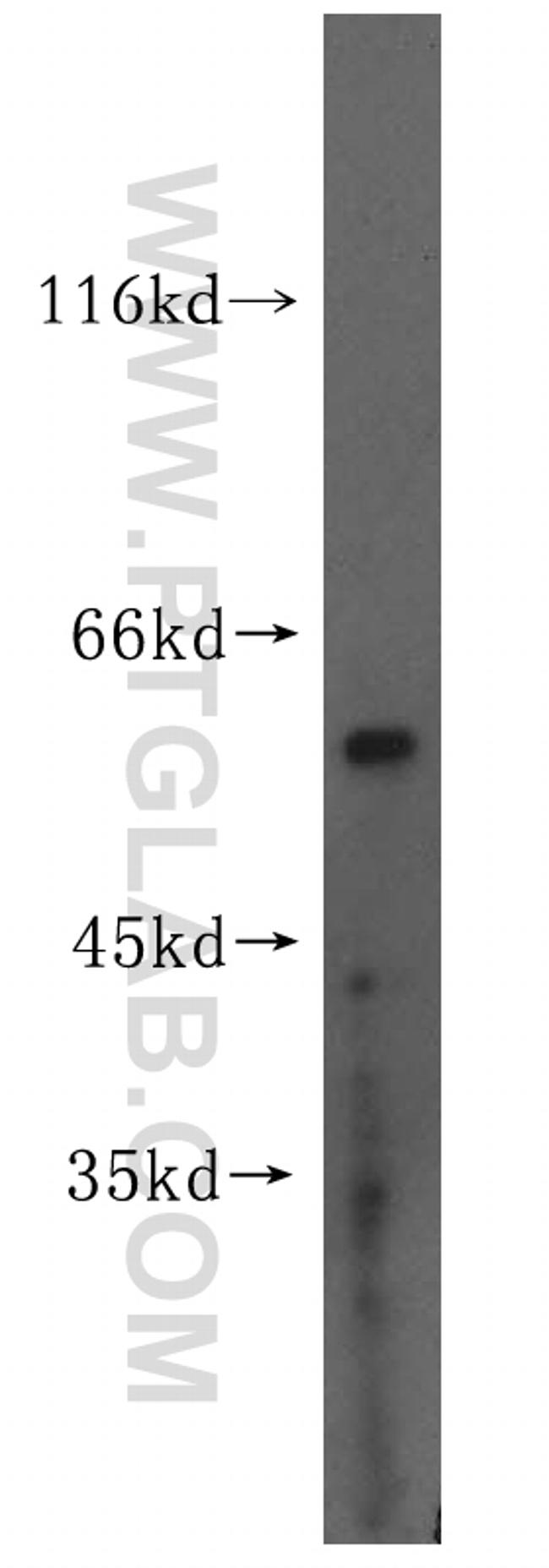 MEK5 Antibody in Western Blot (WB)