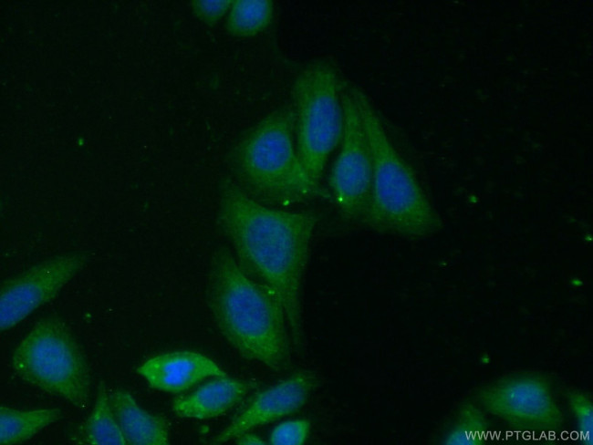 CHMP1A Antibody in Immunocytochemistry (ICC/IF)