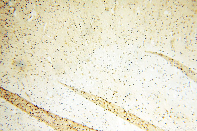 CHMP1A Antibody in Immunohistochemistry (Paraffin) (IHC (P))