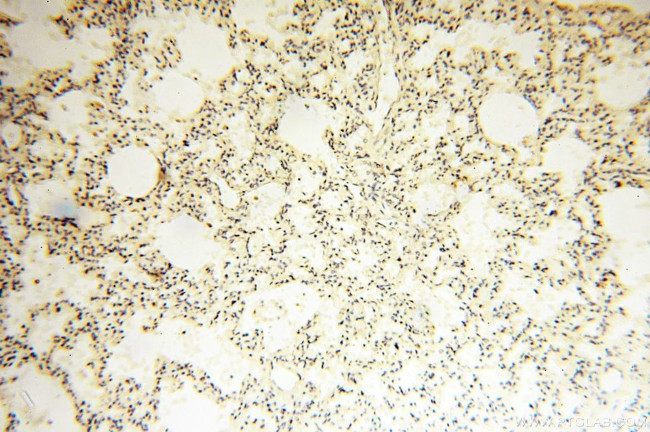 CHMP1A Antibody in Immunohistochemistry (Paraffin) (IHC (P))