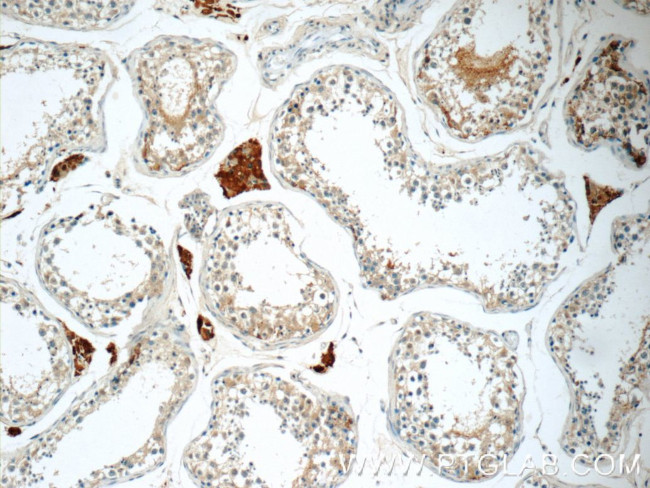 CHMP1A Antibody in Immunohistochemistry (Paraffin) (IHC (P))