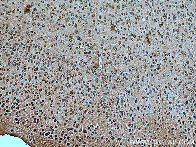 CHMP1A Antibody in Immunohistochemistry (Paraffin) (IHC (P))