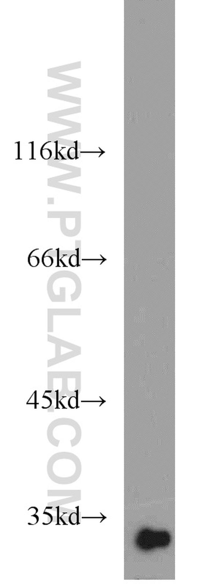 CHMP1A Antibody in Western Blot (WB)