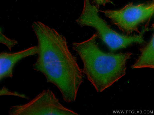 NQO2 Antibody in Immunocytochemistry (ICC/IF)