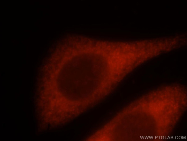 NQO2 Antibody in Immunocytochemistry (ICC/IF)