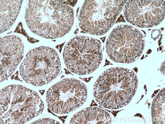 NQO2 Antibody in Immunohistochemistry (Paraffin) (IHC (P))