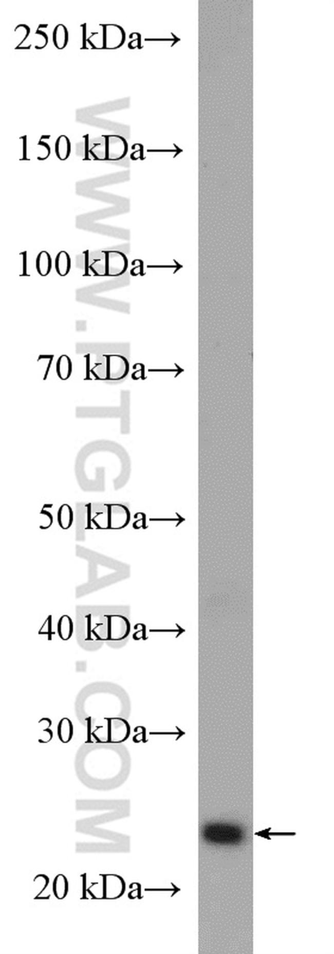 NQO2 Antibody in Western Blot (WB)