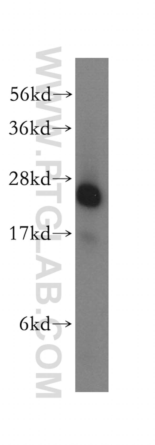 NQO2 Antibody in Western Blot (WB)