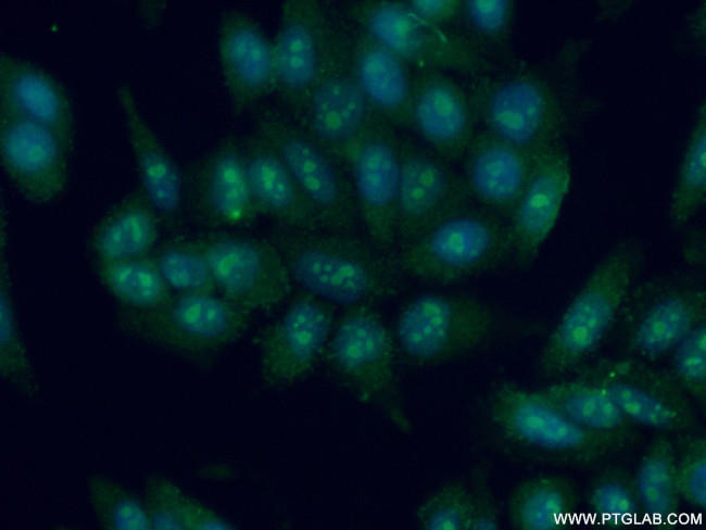 DDX24 Antibody in Immunocytochemistry (ICC/IF)
