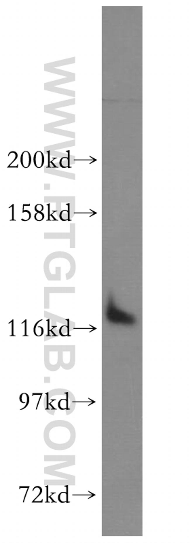 DDX24 Antibody in Western Blot (WB)