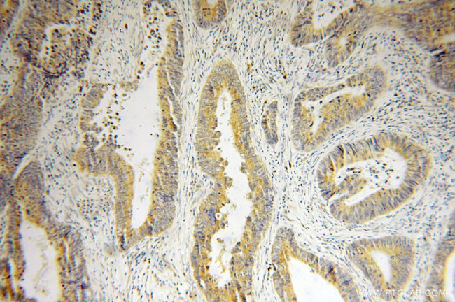 ACAD9 Antibody in Immunohistochemistry (Paraffin) (IHC (P))