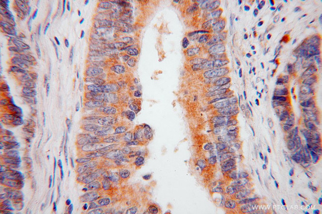 ACAD9 Antibody in Immunohistochemistry (Paraffin) (IHC (P))