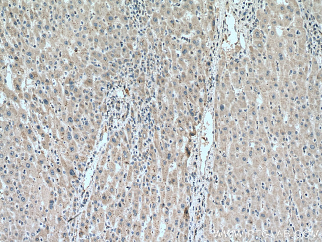 ACAD9 Antibody in Immunohistochemistry (Paraffin) (IHC (P))