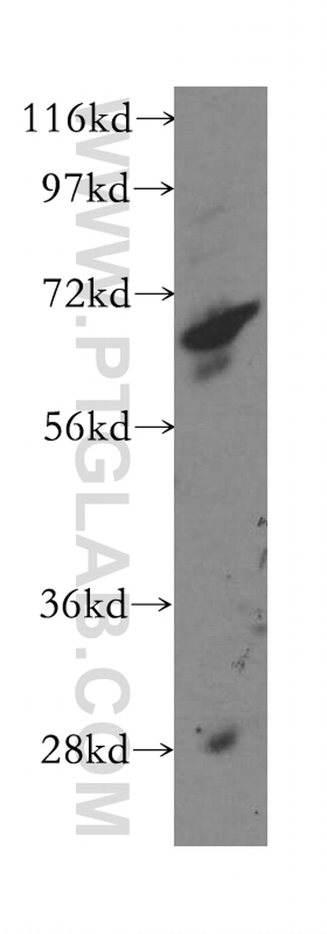 ACAD9 Antibody in Western Blot (WB)