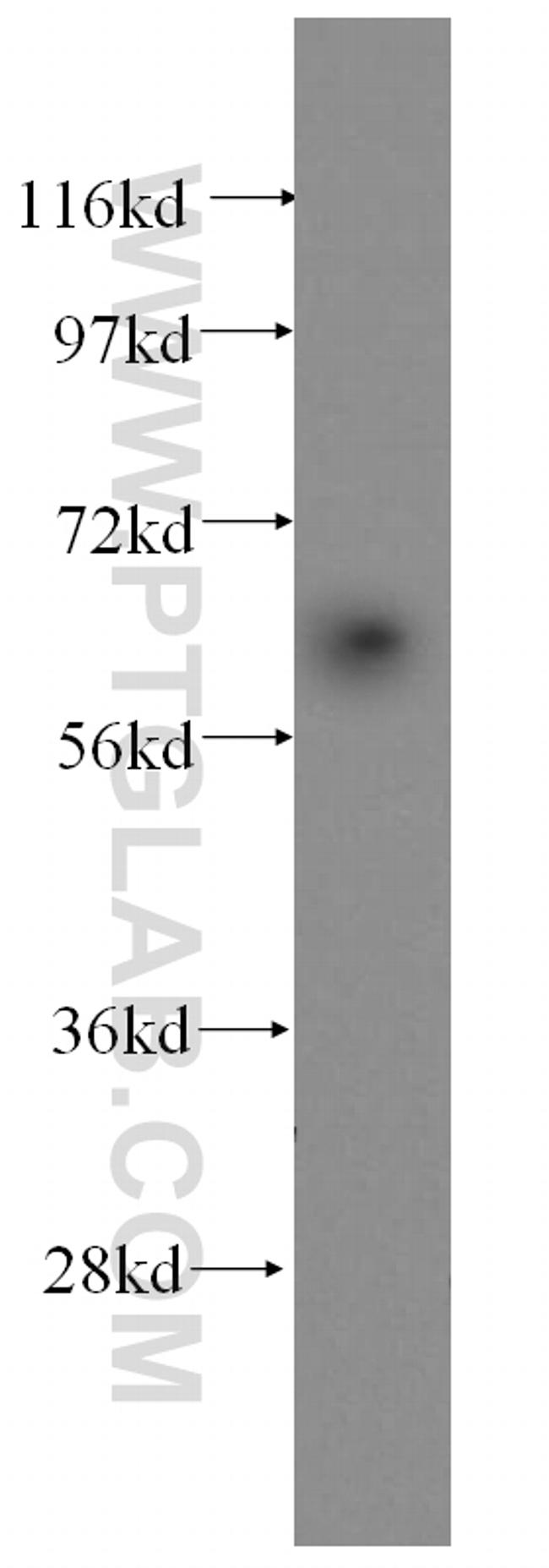 ACAD9 Antibody in Western Blot (WB)