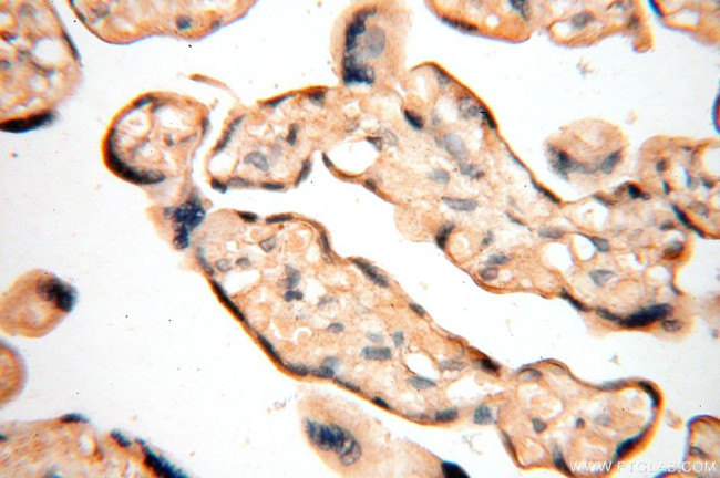 VAC14 Antibody in Immunohistochemistry (Paraffin) (IHC (P))