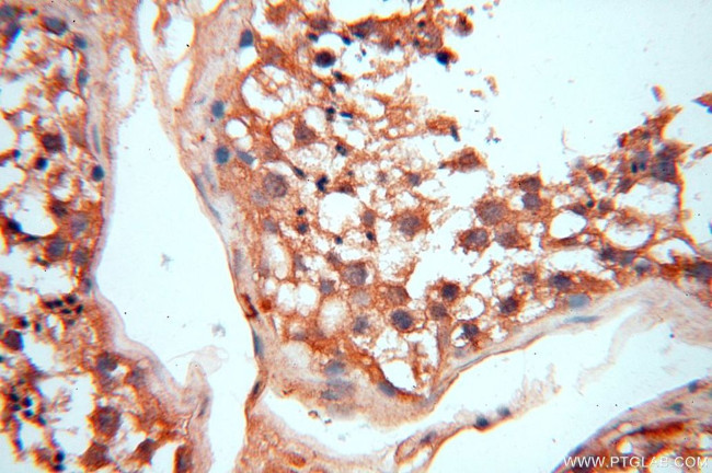 VAC14 Antibody in Immunohistochemistry (Paraffin) (IHC (P))