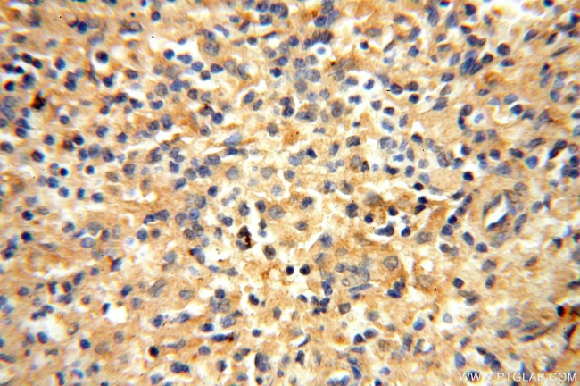 VAC14 Antibody in Immunohistochemistry (Paraffin) (IHC (P))