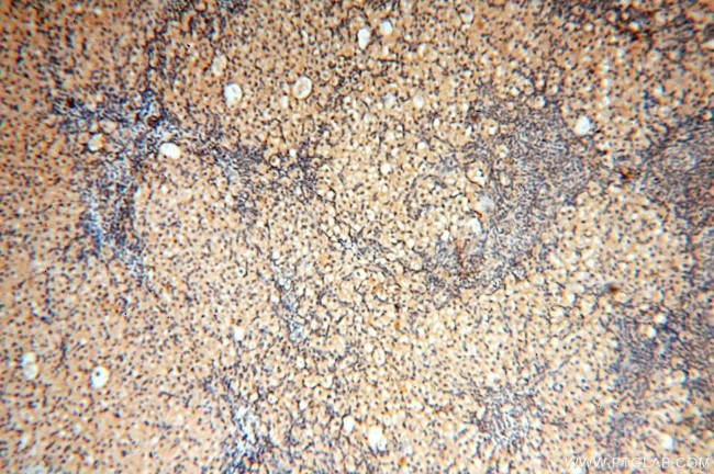 VAC14 Antibody in Immunohistochemistry (Paraffin) (IHC (P))