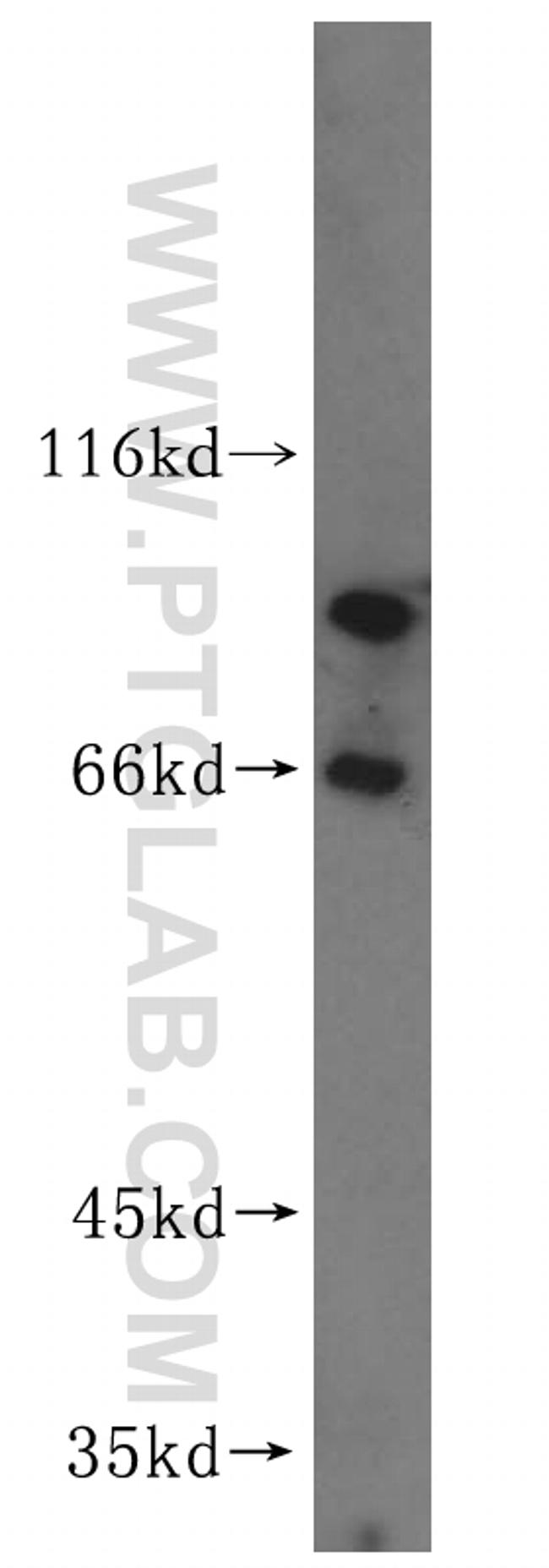 VAC14 Antibody in Western Blot (WB)