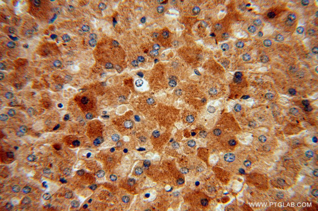 MGAT2 Antibody in Immunohistochemistry (Paraffin) (IHC (P))