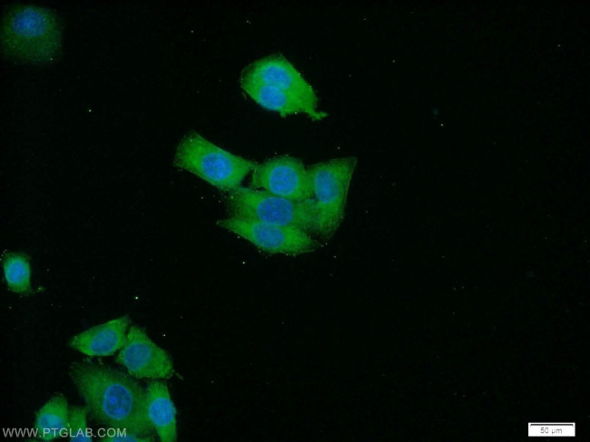 RAB3B Antibody in Immunocytochemistry (ICC/IF)