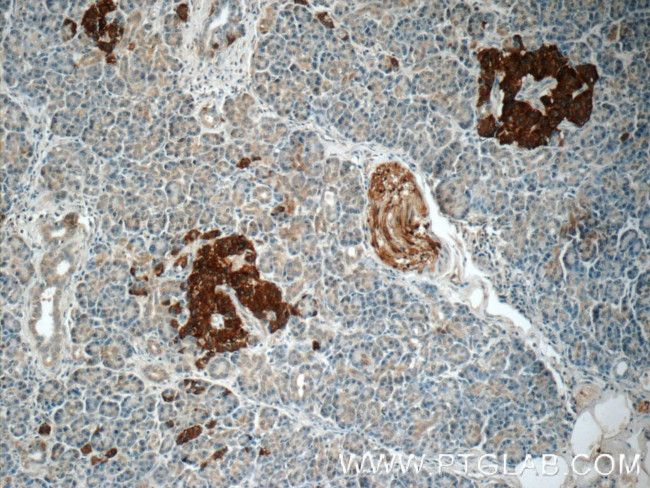 RAB3B Antibody in Immunohistochemistry (Paraffin) (IHC (P))