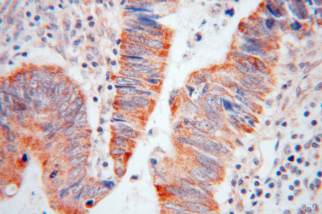 RAB3B Antibody in Immunohistochemistry (Paraffin) (IHC (P))