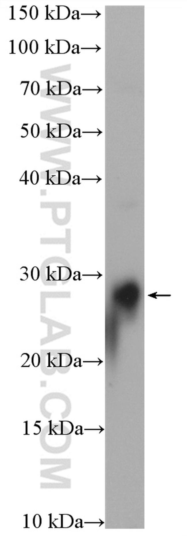 RAB3B Antibody in Western Blot (WB)